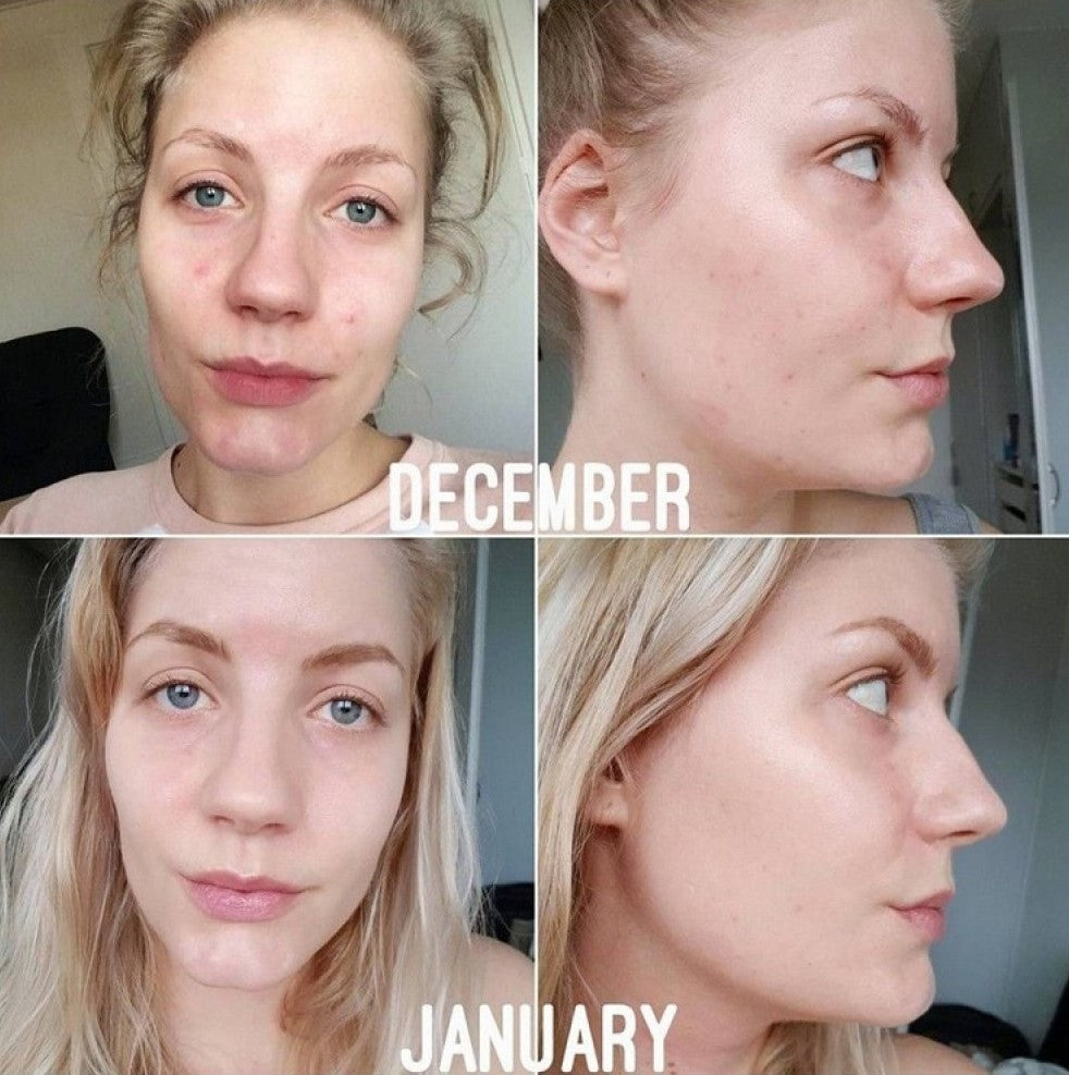 The Ordinary Niacinamide 10% + Zinc 1% Serum – Master Copy | 30ml